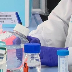 Pesquisadores de Luxemburgo contribuem para a pesquisa da síndrome de Zellweger.