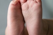 50 anos do Teste do Pezinho: diagnóstico precoce de doenças raras ainda enfrenta desafios no Brasil